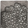 Nodule 5