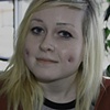 Cheek Dimple Piercings