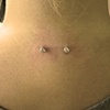 Nape Surface Piercing