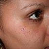 Gypsy Tear Micro Dermal