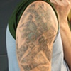 Kurt's Arm 10