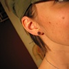 Dermal Punched Earlobe with CZ Plug