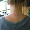 Nape Surface barbell