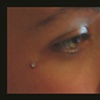 Micro Dermal Eye