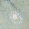 Site Excavation (detail)