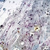Hydra (detail)