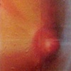 Breast