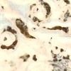PN 031