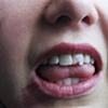 Teeth, 2010