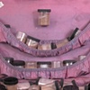 Suitcase (Resource)