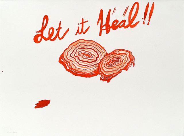 let it heal