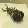 Ulcus (2nd view)