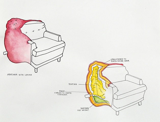 Armchair with Lipoma