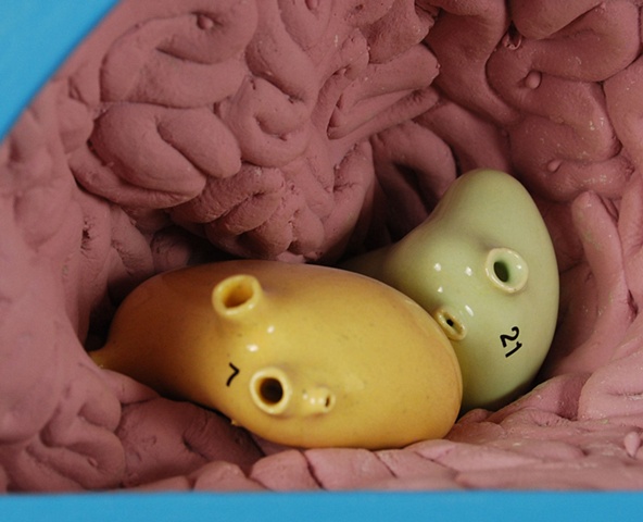 inflamed Organs #7 and #21