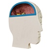 Inflamed Organs #7 and #21