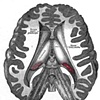 Pineal Actions