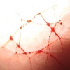 My Skin II
