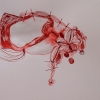 arm diagram