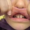 smily piercing by tatupaul