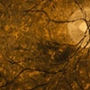 Do You See It?