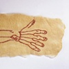 Deep Arteries of the Arm