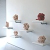 Small Intestines:I-VII