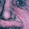 Albert
