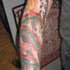 Josh's lower arm