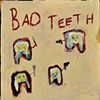 bad teeth