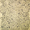 Accumulations I