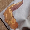 Napkin for ____ after gastric bypass
