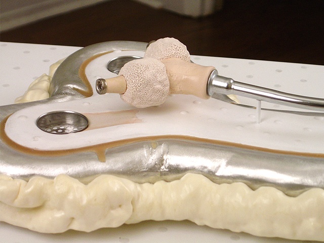 DUAL SOAKSTICK DETAIL