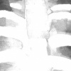 X-Ray