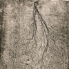 Bundle