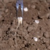 Teeth Roots