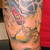 pat's arm 4