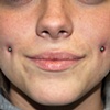 Dimples
