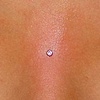 Chest dermal