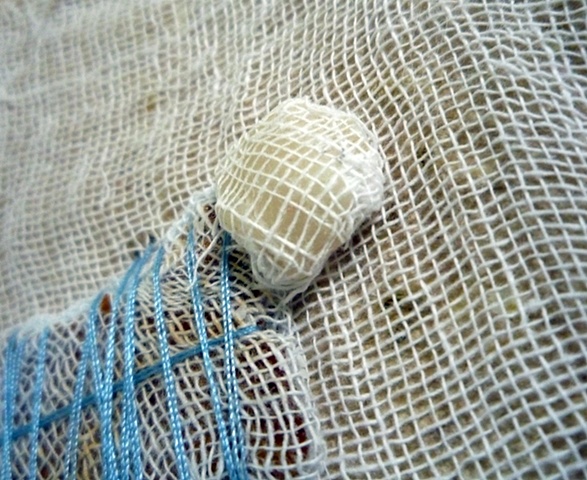 Detail 1