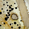 Antinuclear Antibodies (Detail 6)