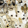 Antinuclear Antibodies (Detail 8)