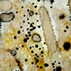 Antinuclear Antibodies (Detail 2)