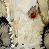 Antinuclear Antibodies (Detail 9)