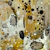 Antinuclear Antibodies (Detail 1)