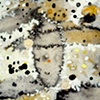 Antinuclear Antibodies (Detail 4)
