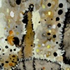 Antinuclear Antibodies (Detail 5)