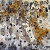Antinuclear Antibodies (Whole)