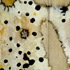 Antinuclear Antibodies (Detail 7)