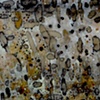 Antinuclear Antibodies