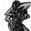 Scoliosis